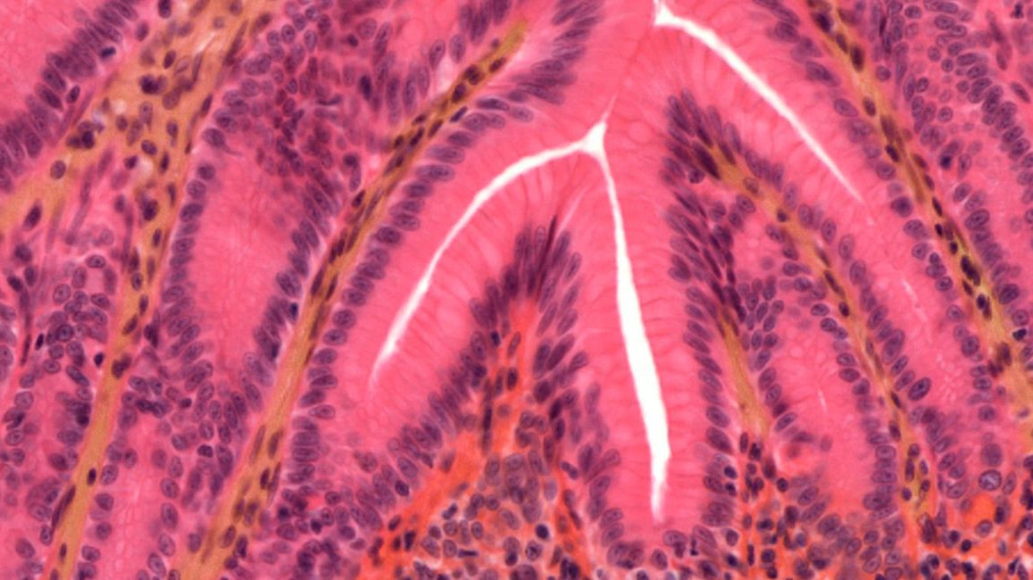 Your gut is quietly in charge, housing 70% of your immune system