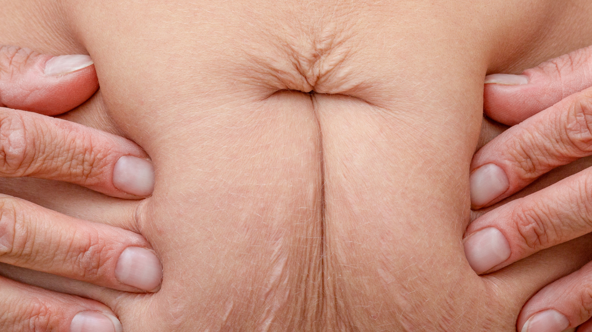 How stress is sabotaging your waistline