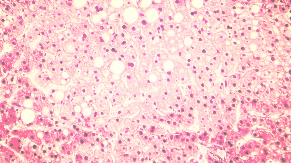 Metabolic Gold for liver health