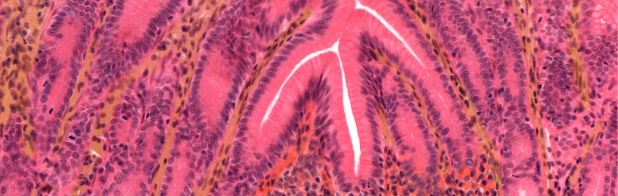 Your gut is quietly in charge, housing 70% of your immune system