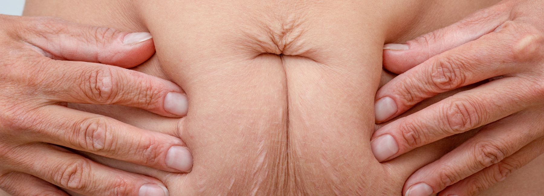 How stress is sabotaging your waistline