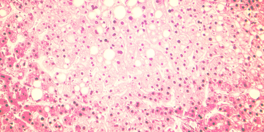 Metabolic Gold for liver health
